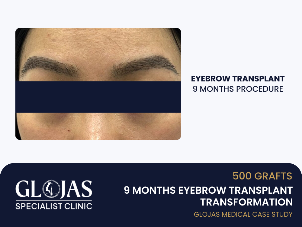 tanam-kening-9-bulan