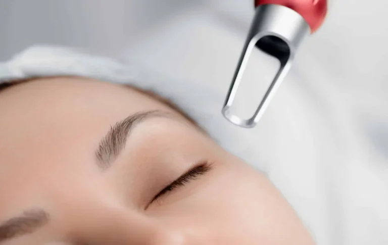 pico-laser-treatment-picosure-laser-q-switch-laser-kuala-lumpur-malaysia