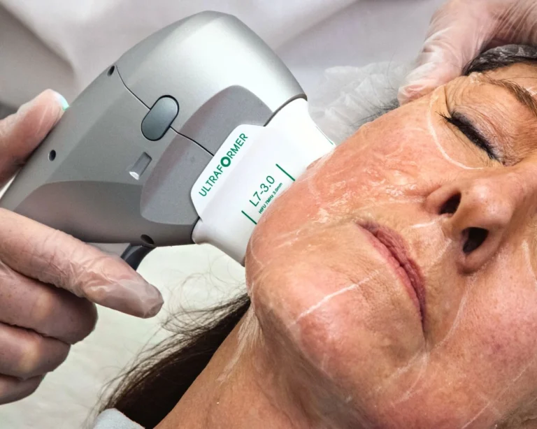 HIFU-Treatment-kuala-lumpur-malaysia