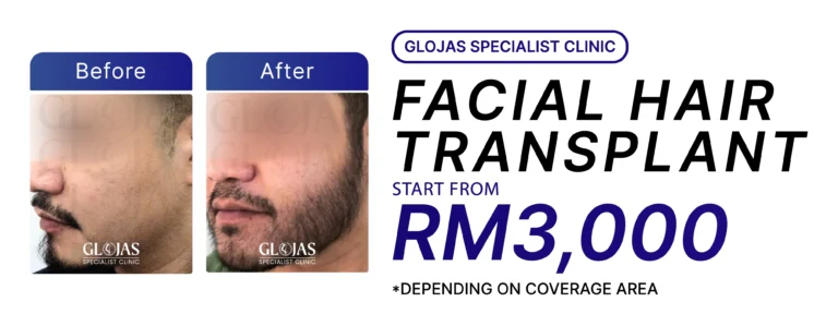 beard transplant malaysia