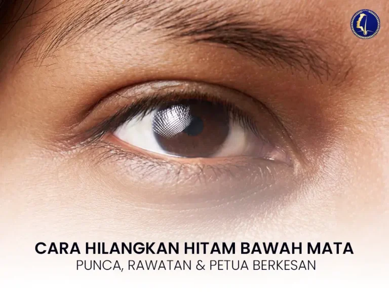cara-hilangkan-hitam-bawah-mata