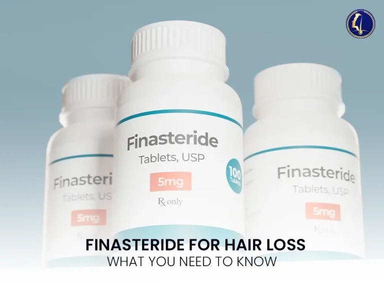 finasteride-hair-loss