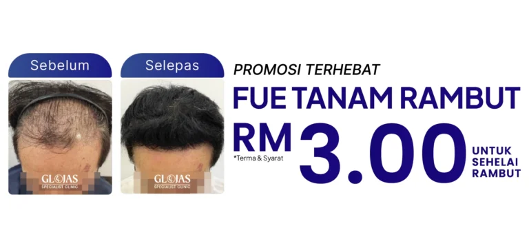 tanam-rambut-malaysia