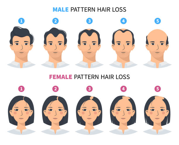 hair-loss-treatment-malaysia-male-female-pattern-hairloss