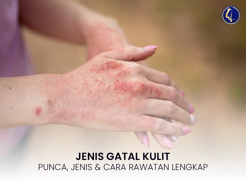 jenis-gatal-kulit