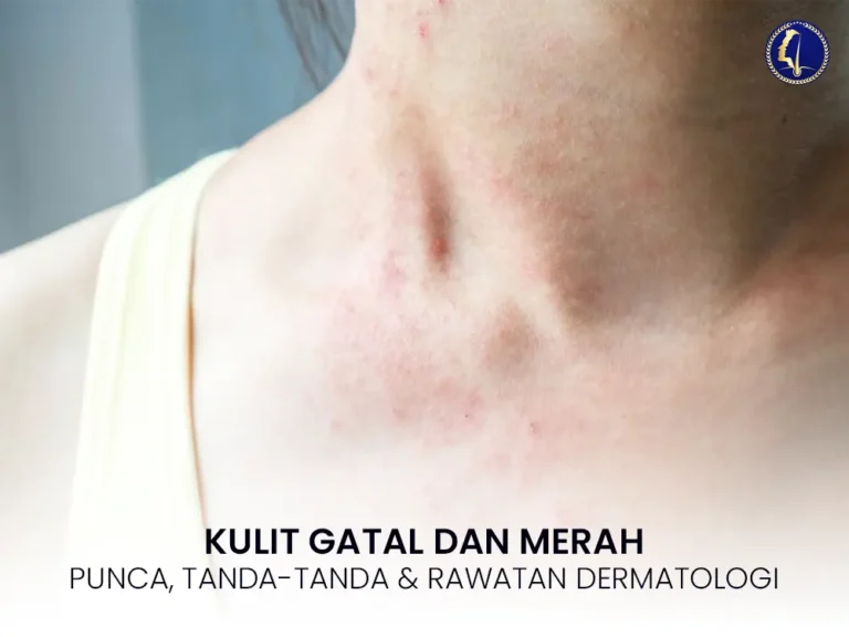 kulit-gatal-dan-merah-rawatan