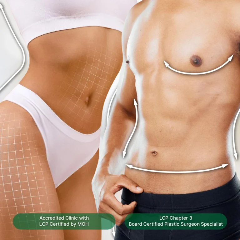 liposuction-fat-removal-Kl-14