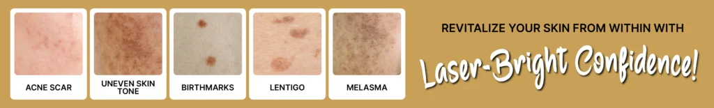 medlite laser skin treatment malaysia