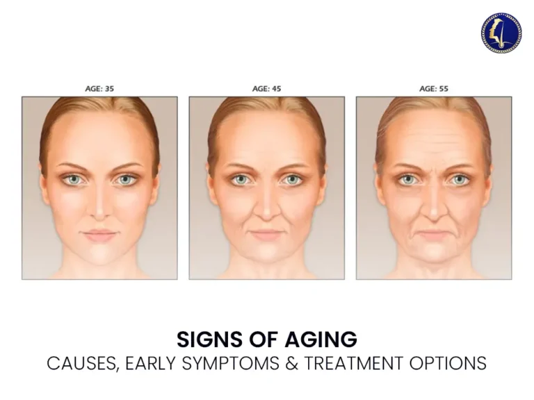 signs-of-aging