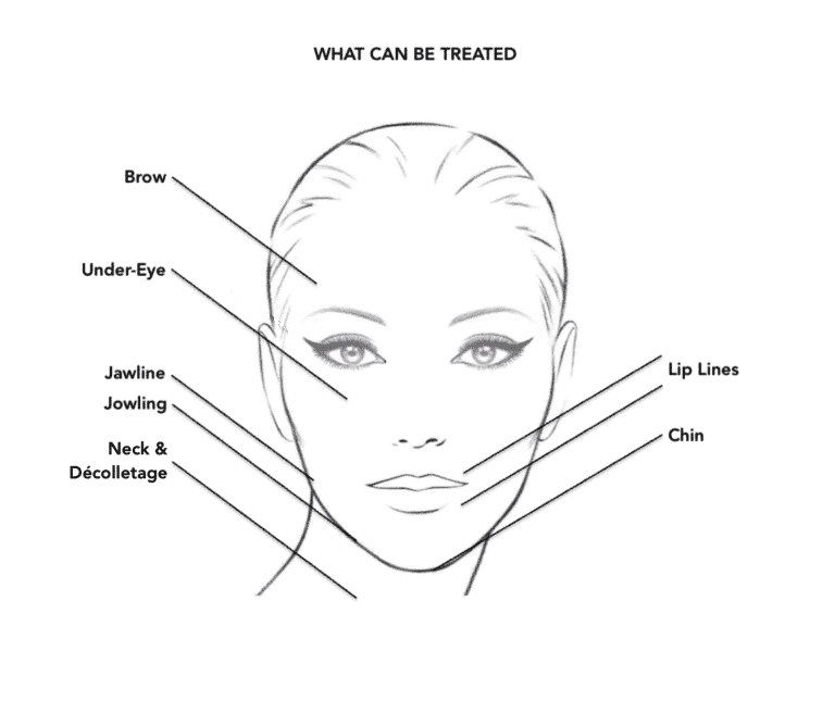 endolift-skin-tightening-trusted-clinic-malaysia