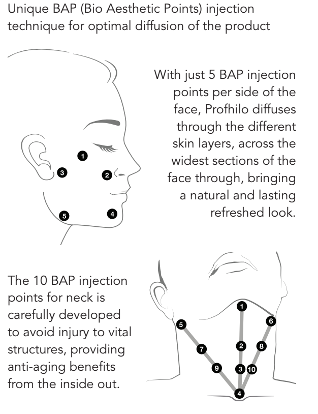 profhilo-BAP-Injection-Point