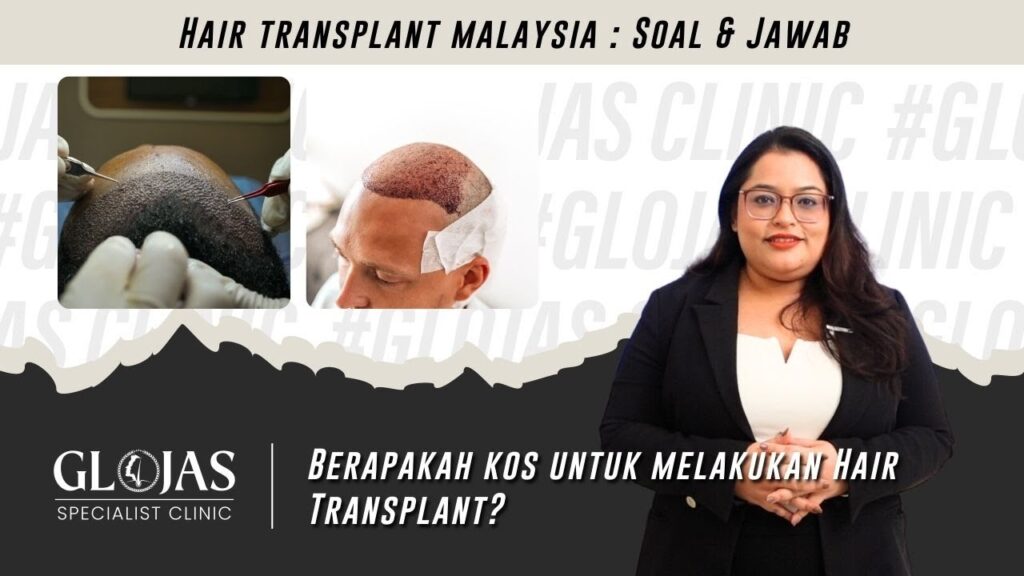 Hair Transplant in Malaysia | Tanam Rambut: Berapakah Kos untuk Hair Transplant? 19 tanam-rambut-kos