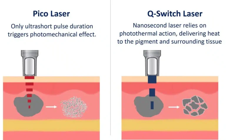 pico-laser-technology