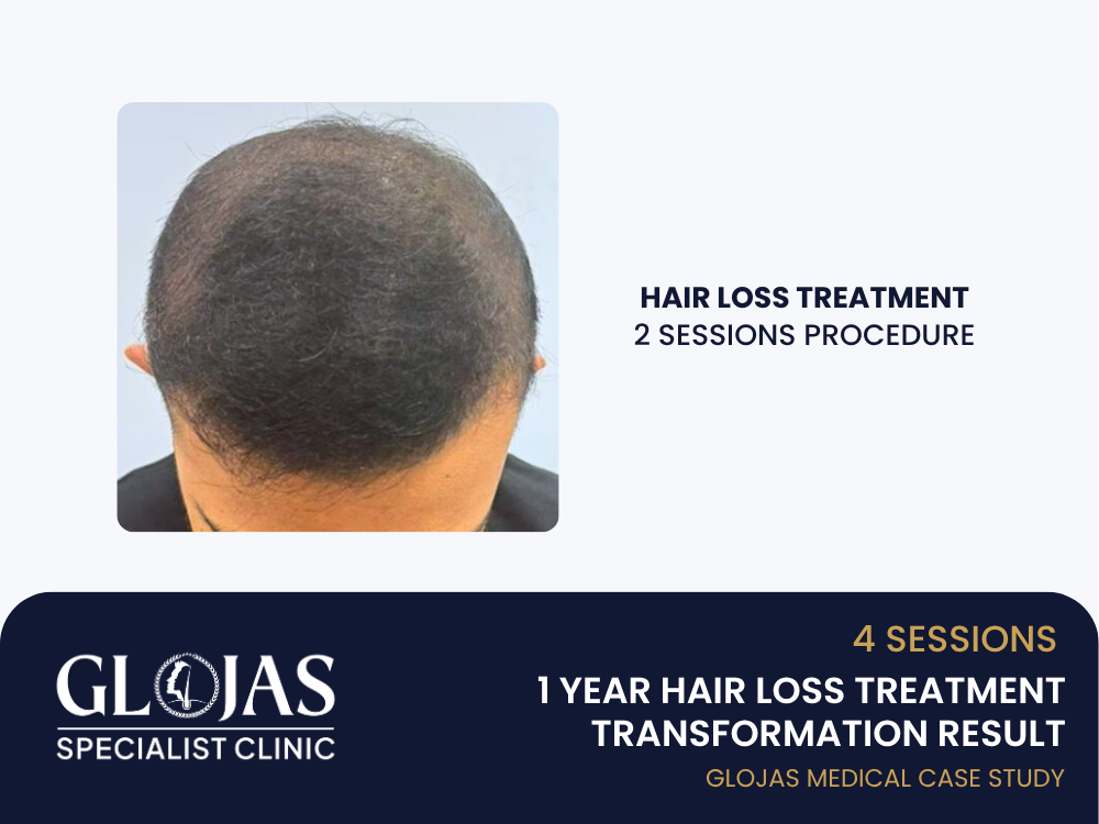 hair-loss-treatment-session-2