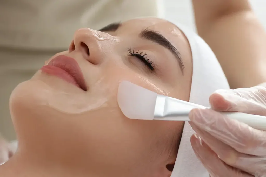 chemical-peel-acne-treatment-malaysia