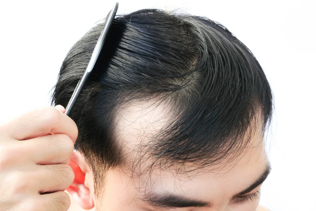 hair-loss-treatment-scalp-care