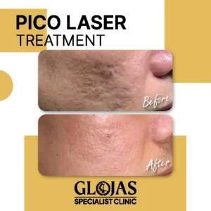 fat-reduction-before-after-result-8
