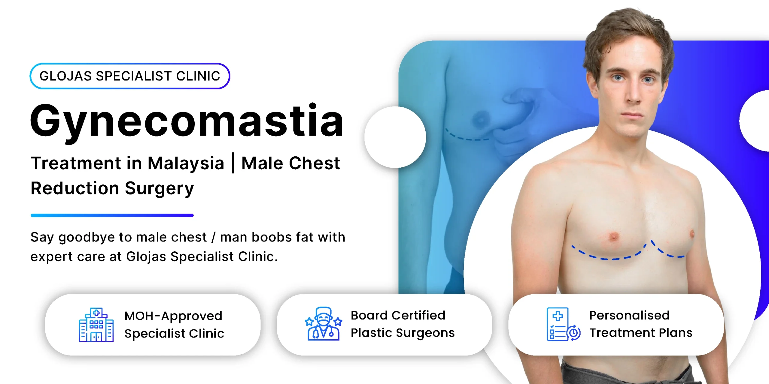 gynecomastia-treatment