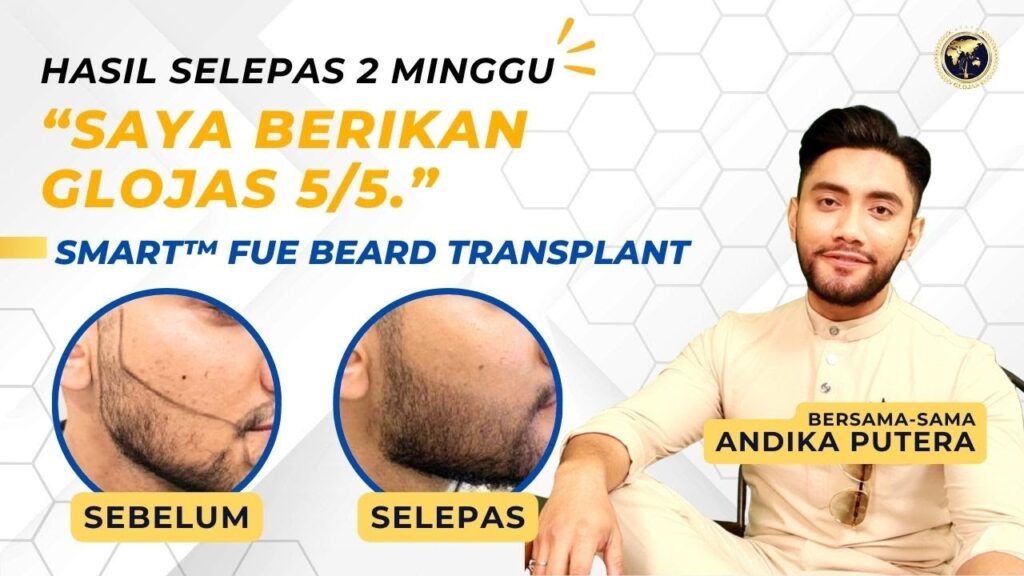 tanam-jambang-2-minggu