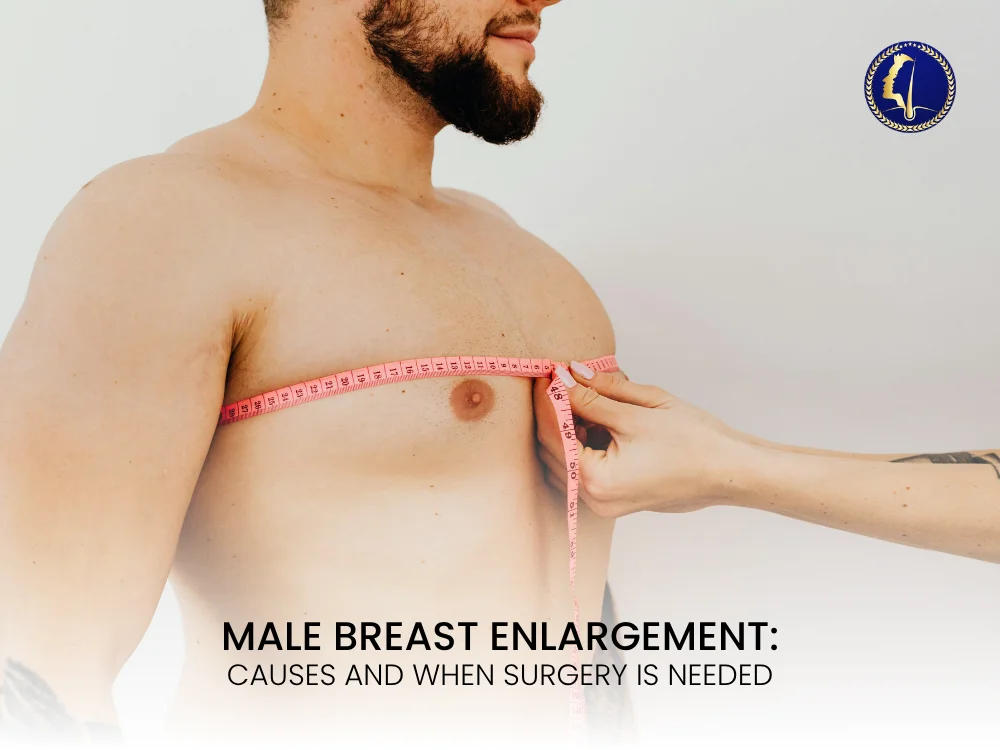 Causes of Male Breast Enlargement and When Surgery Is Needed