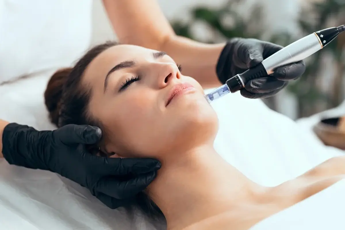 microneedling-skin-texture-treatment