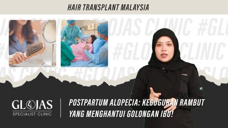 postpartum-alopecia