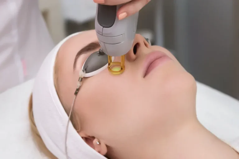 skin-laser-acne-treatment-malaysia
