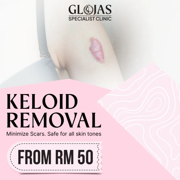 plastic-surgery-clinic-aesthetic-clinic-hair-transplant-clinic-malaysia-promotion-glojas