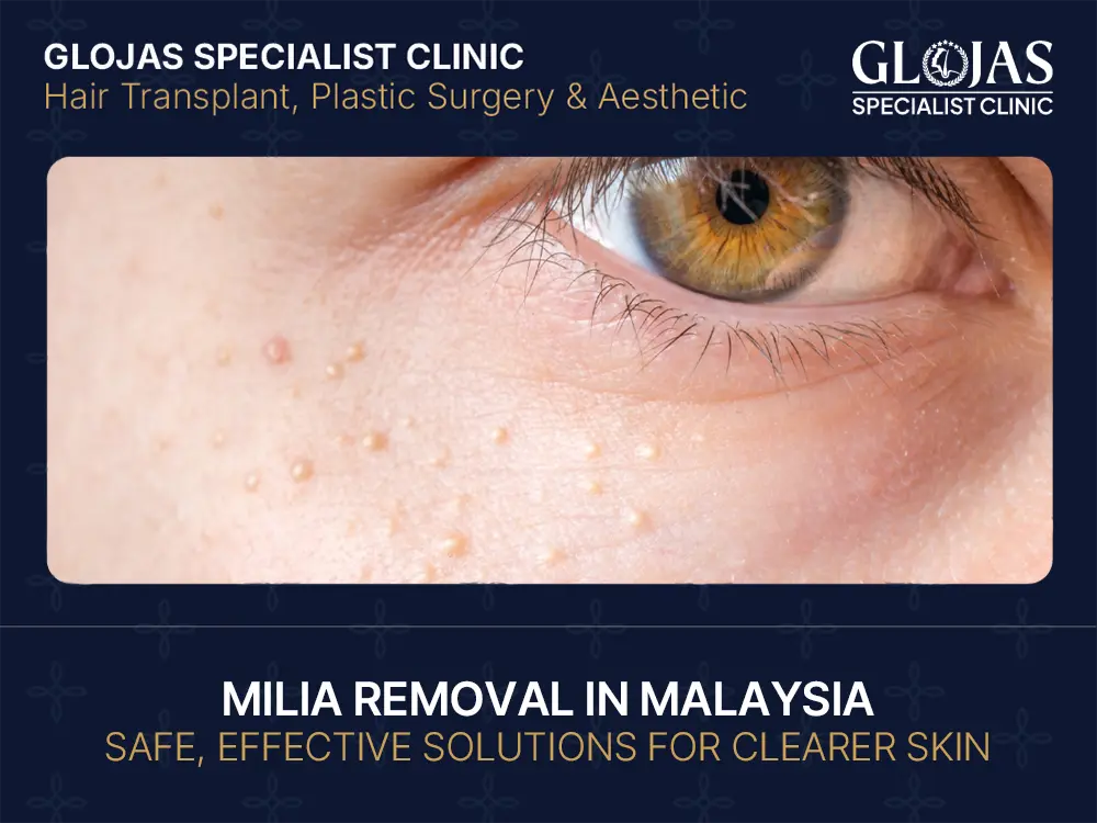 Milia Removal: Causes, Safe Treatments & Prevention Tips for Clear Skin