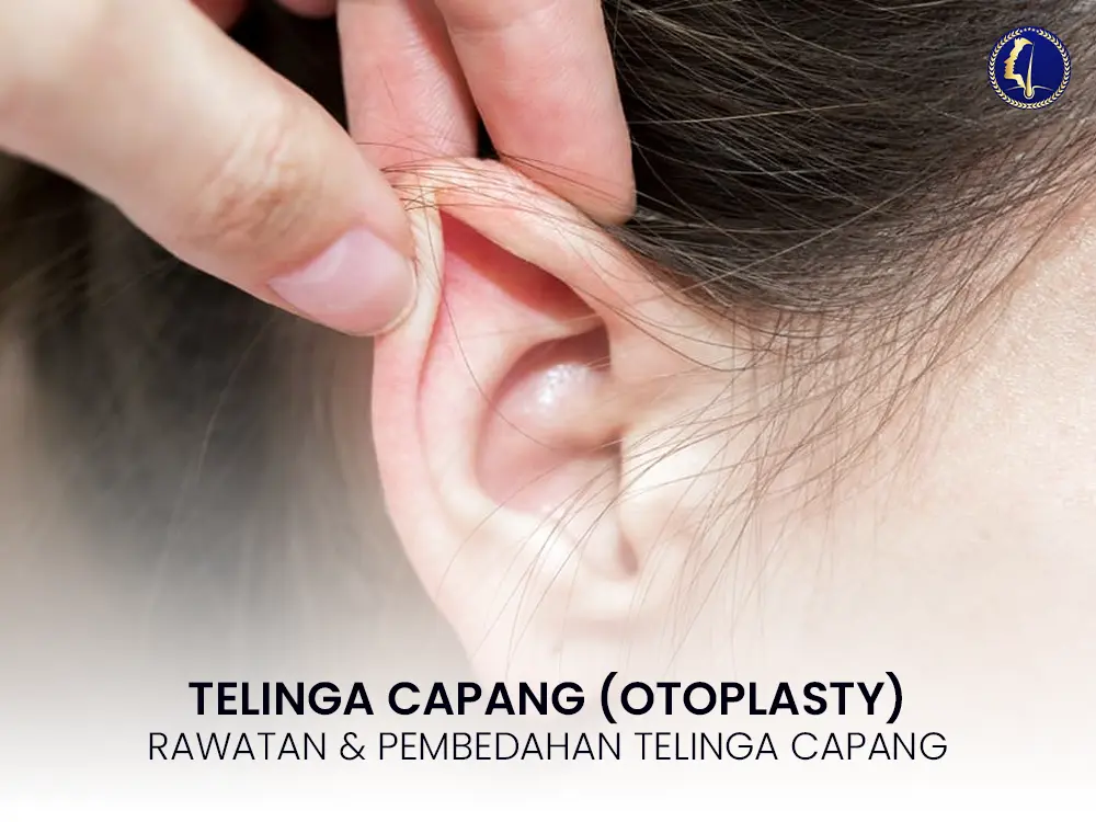 Telinga Capang (Otoplasty): Rawatan & Pembedahan Telinga Capang di Malaysia