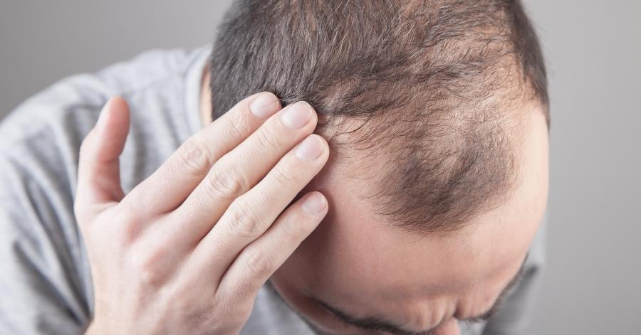 Shampoo Terbaik Untuk Rambut Gugur: 6 Bahan Yang Paling Berkesan 2 syampu-untuk-rambut-gugur
