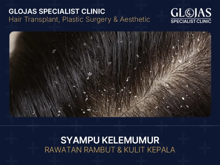 SYAMPU KELEMUMUR