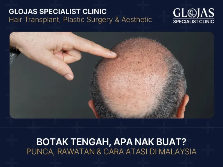 botak-tengah