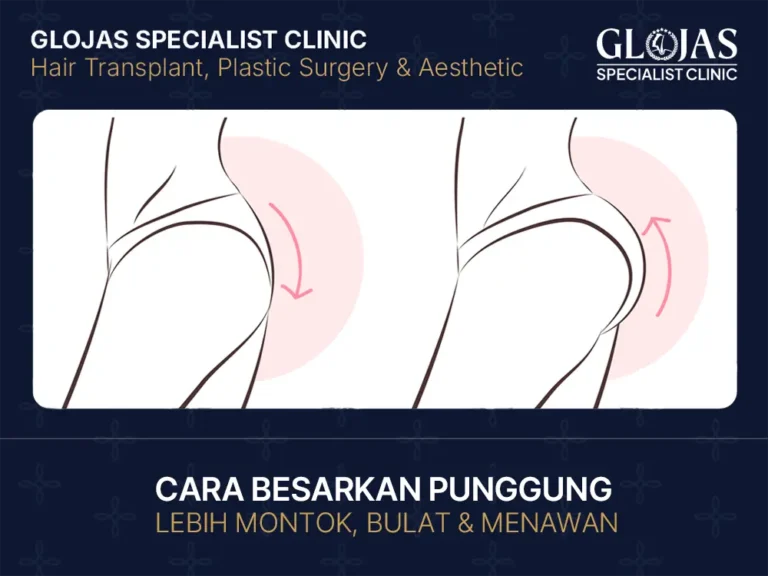 cara-besarkan-punggung