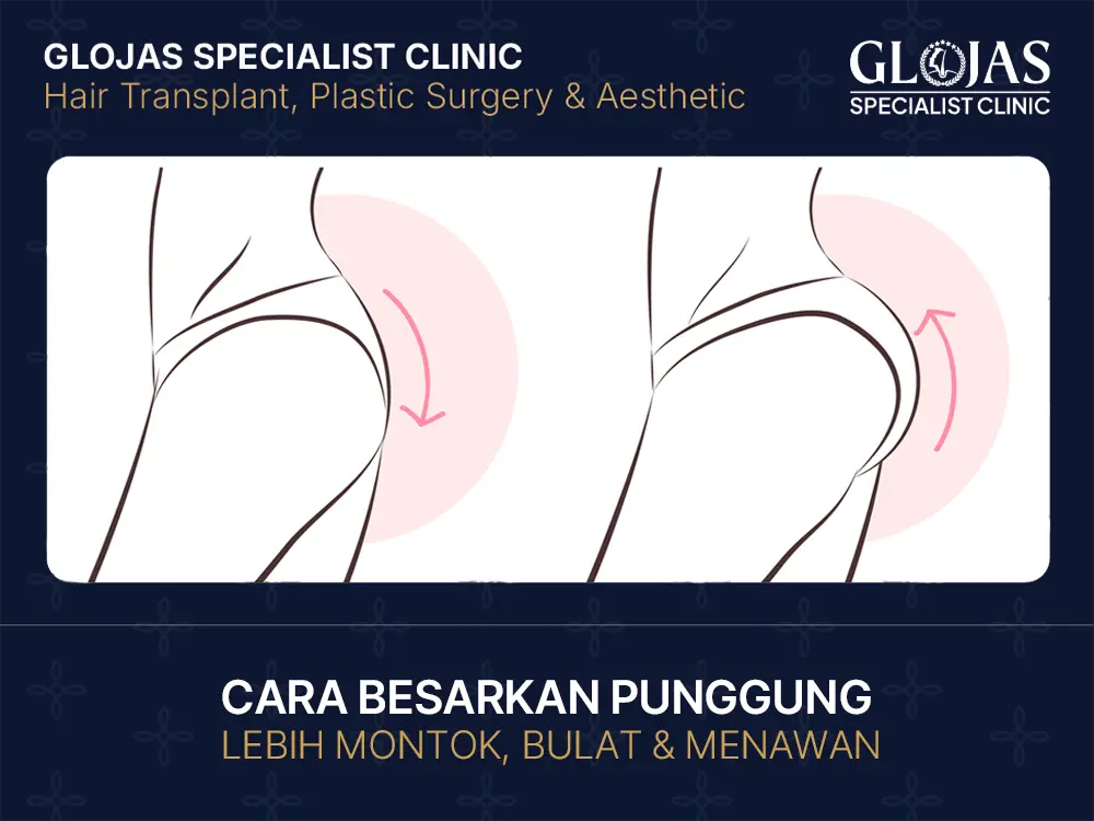 Cara Besarkan Punggung Supaya Lebih Montok, Bulat & Menawan
