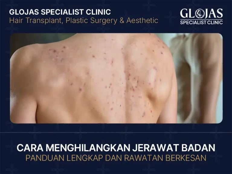 cara-hilangkan-jerawat-badan
