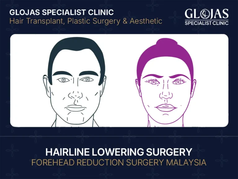 hairline-lowering-surgery-forehead-reduction-malaysia