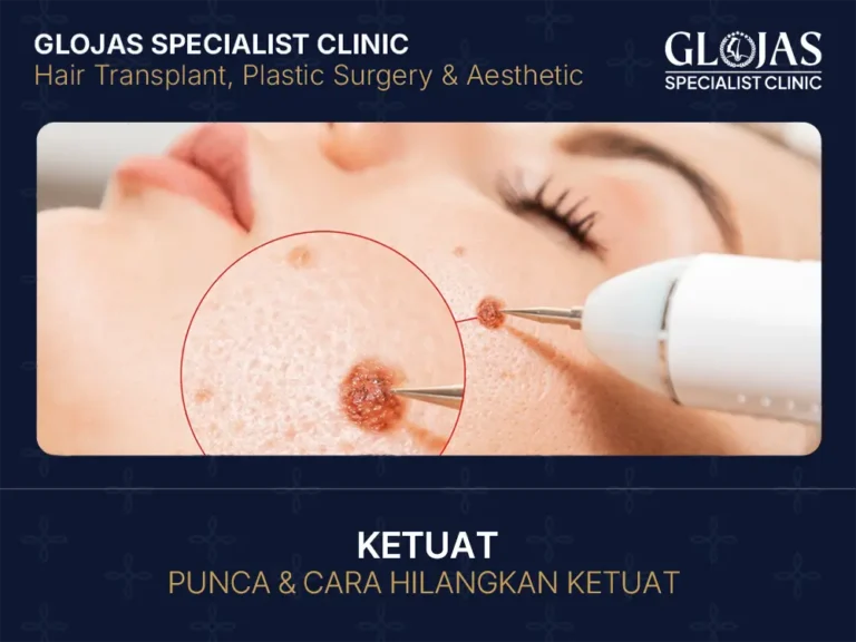 ketuat-kelamin-punca-cara-hilangkan-ketuat