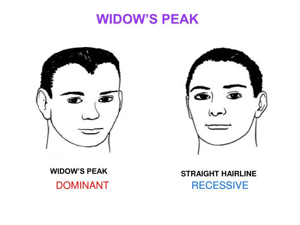 widow’s peak hairline malaysia