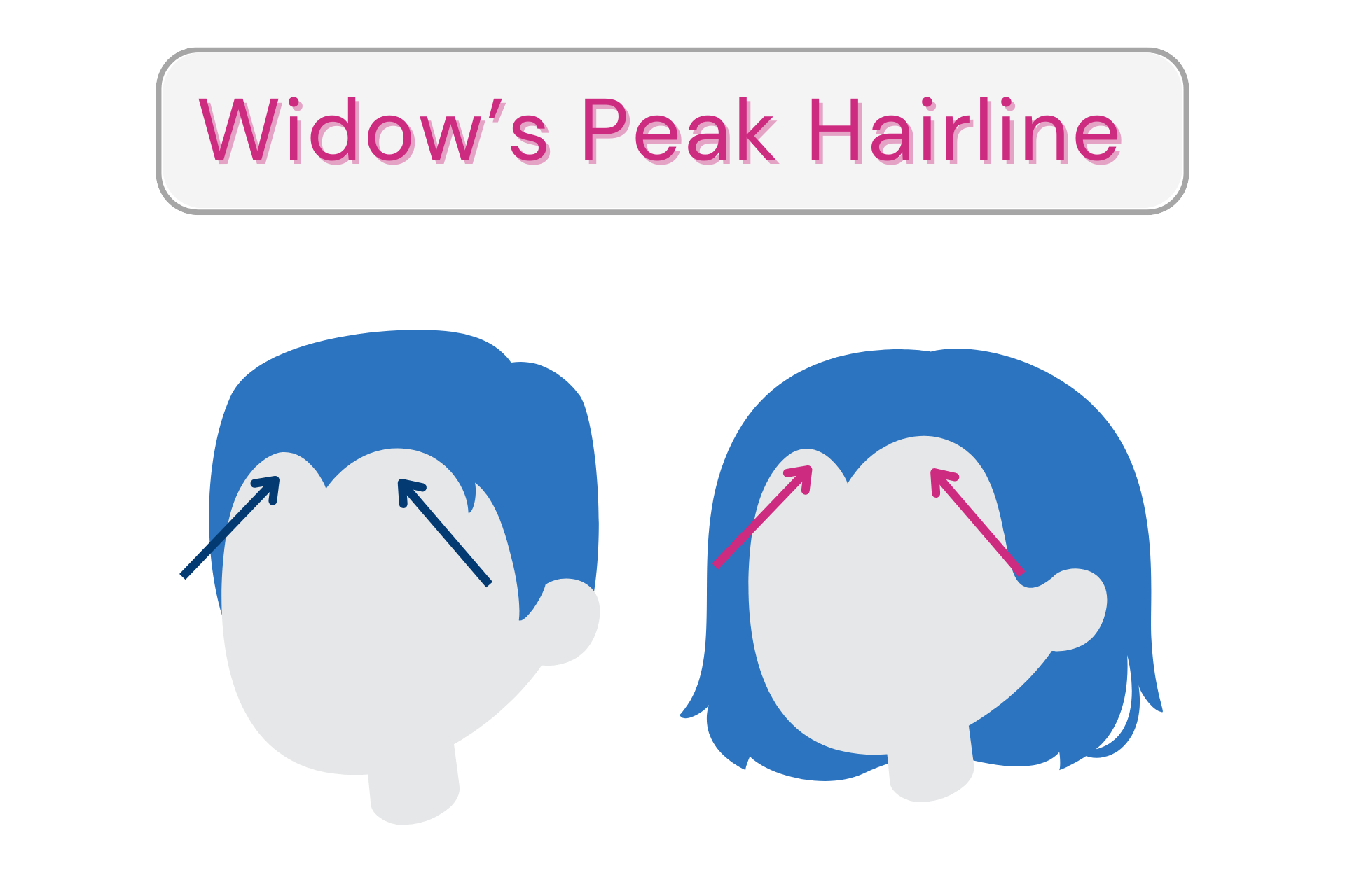 widows-peak-hairline