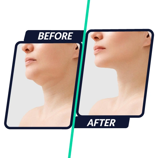 wrinkles line reducing