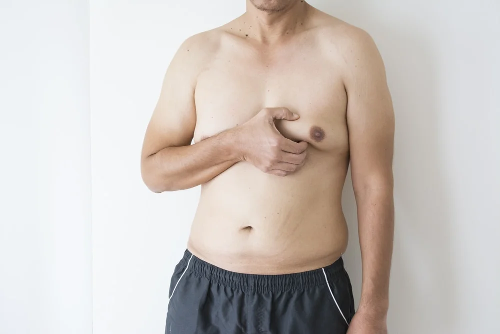 Man-Boobs-gynecomastia