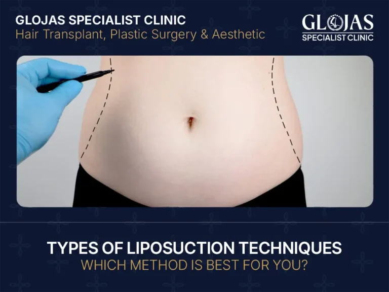 liposuction-techniques