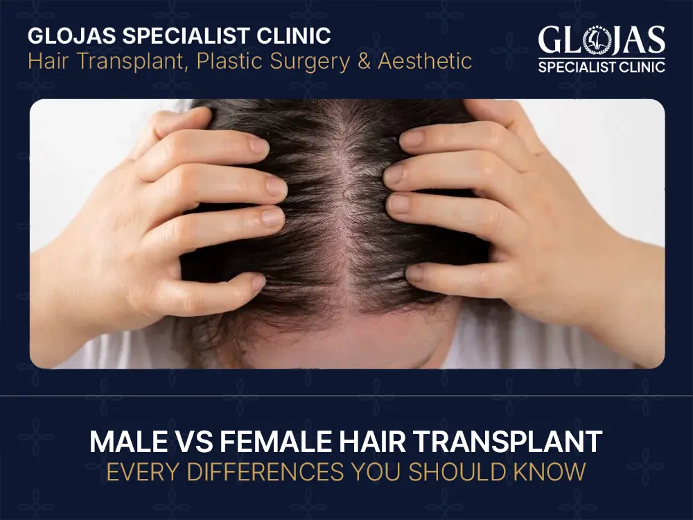 Male vs Female Hair Transplant: Every Differences You Should Know 14 male-vs-female-hair-transplant-malaysia