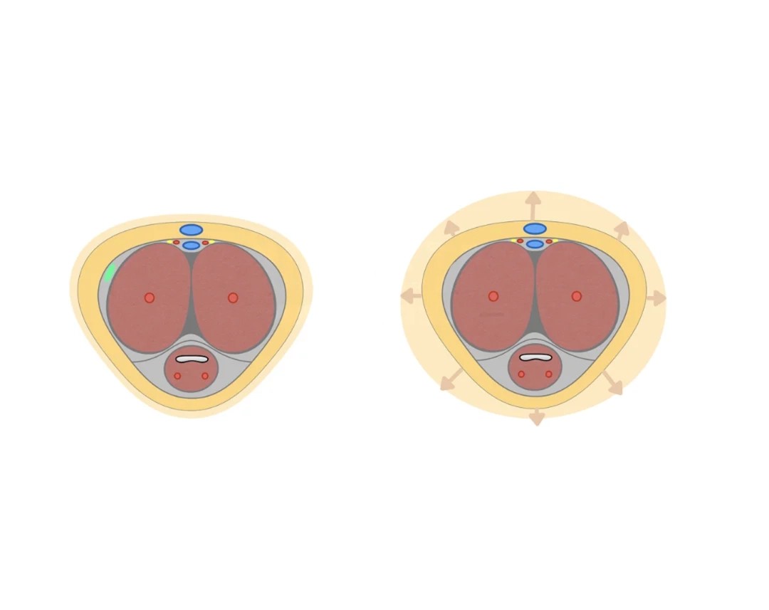 penis-enlargement-surgery-malaysia-1