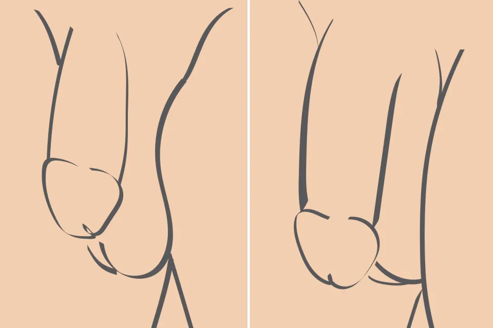 penis-enlargement-surgery-malaysia