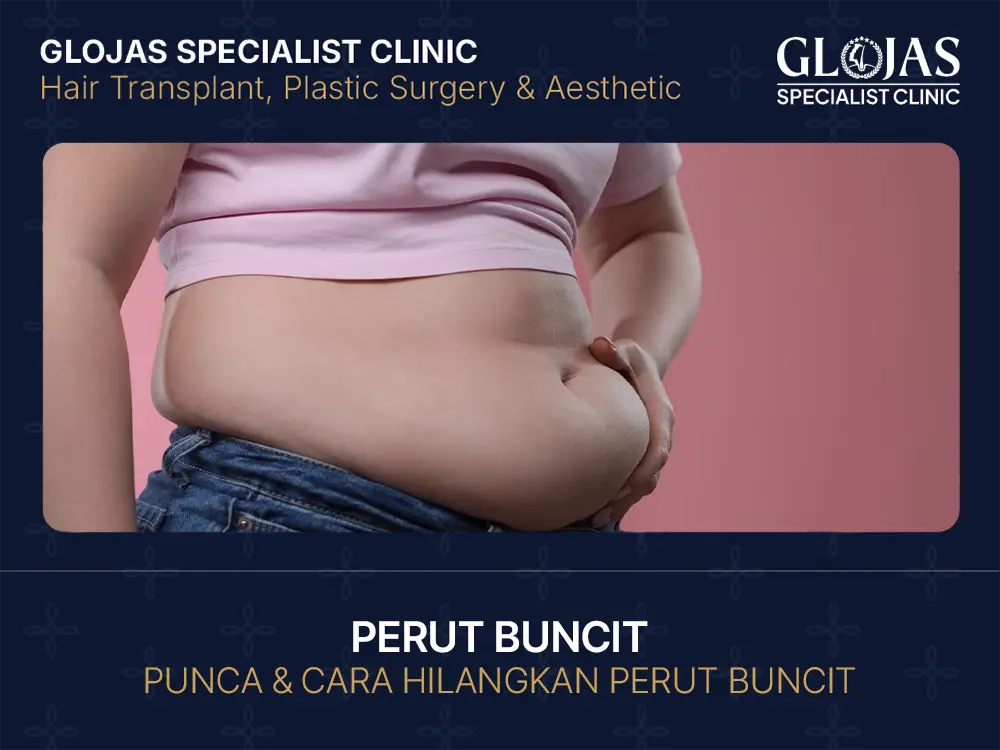 Rahsia Hilangkan Perut Buncit dengan Cara Selamat & Berkesan