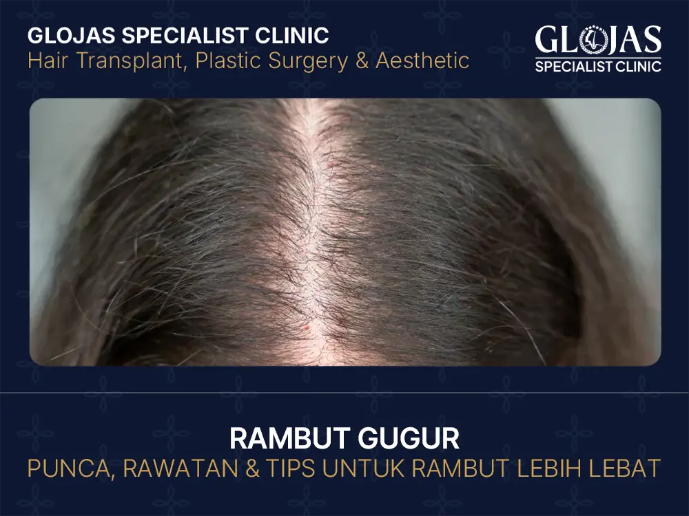 15 Punca Rambut Gugur pada Perempuan & Cara Mengatasinya Dengan Berkesan 5 rambut-gugur-punca
