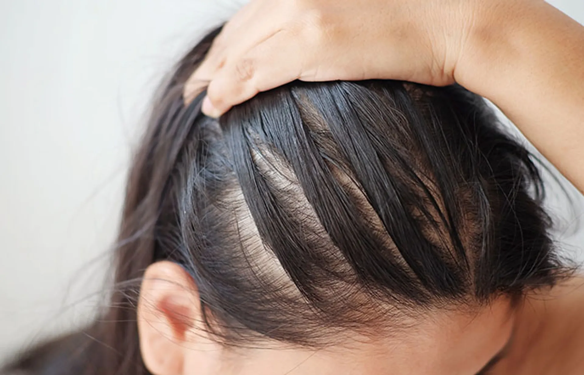 Thinning Hair: Causes, Treatments, and Effective Hair Regrowth Solutions 1 thinning-hair-women