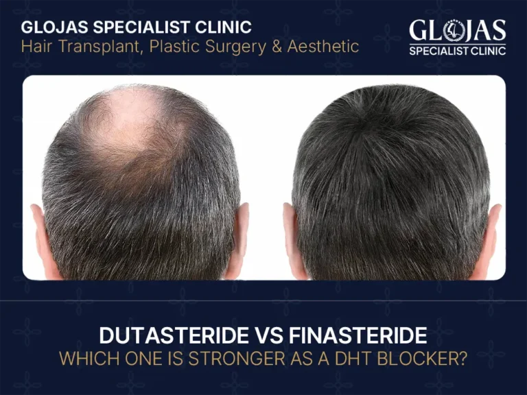 Dutasteride vs Finasteride